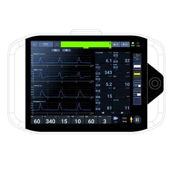 Image TEO pression oesophagienne